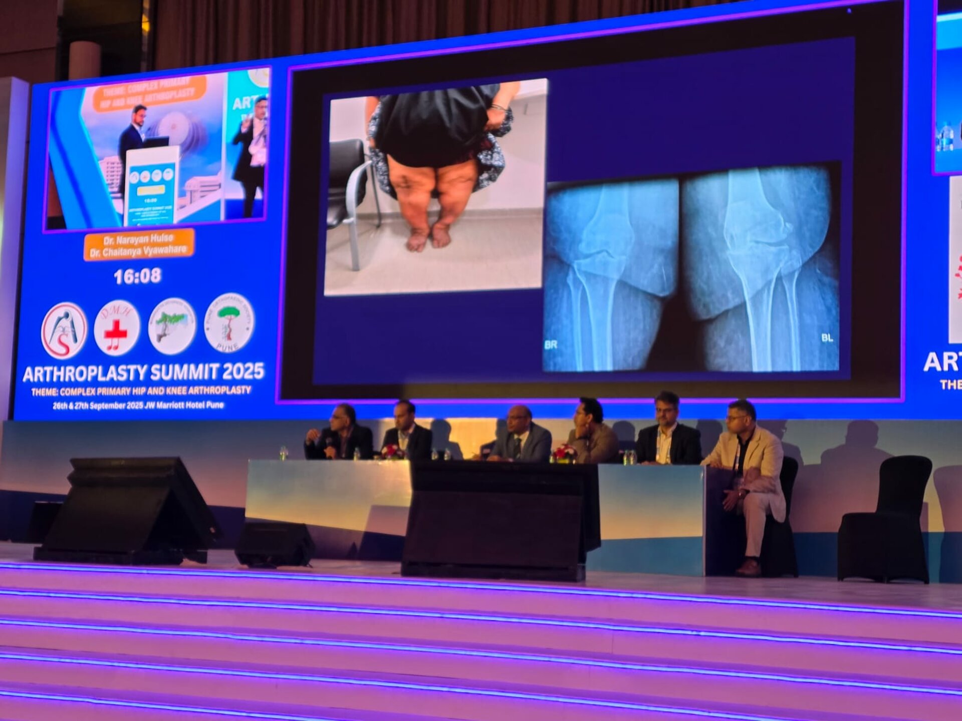 Dr Nakul Shah|Karve Road ,Pune